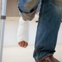 Man with a cast on his leg and crutches Man with a cast on his leg and crutches