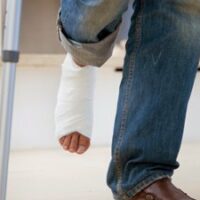 Man with a cast on his leg and crutches