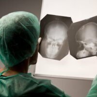 head x-ray head x-ray