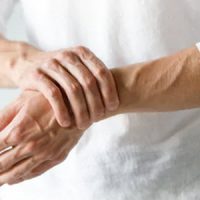 Arthritis Arthritis